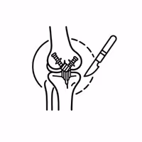 ACL Reconstruction Surgery