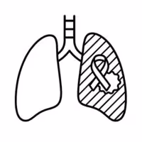 Lung Cancer